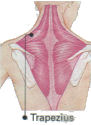 neck_stiffness